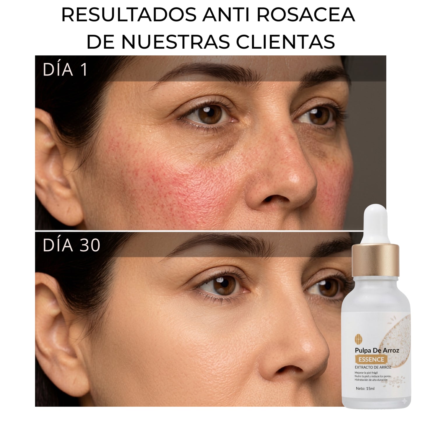 Sérum Pulpa de Arroz - Hidrata, Calma e Ilumina tu piel con 4 Activos Coreanos