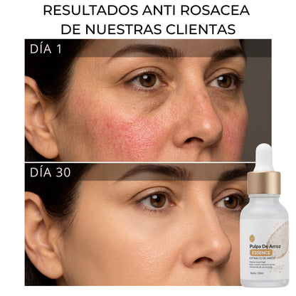 Sérum Pulpa de Arroz - Hidrata, Calma e Ilumina tu piel con 4 Activos Coreanos
